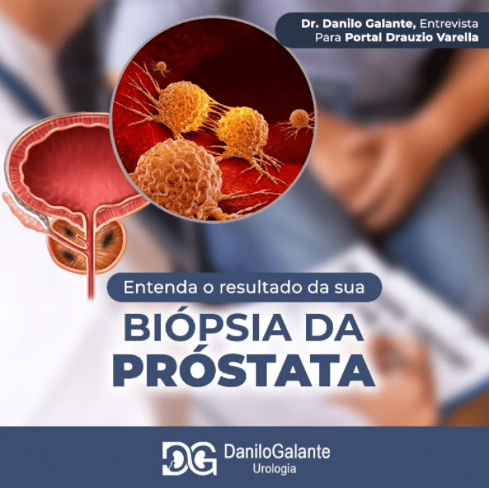Biópsia da Próstata