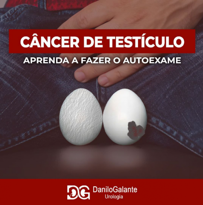 Câncer de Testículo