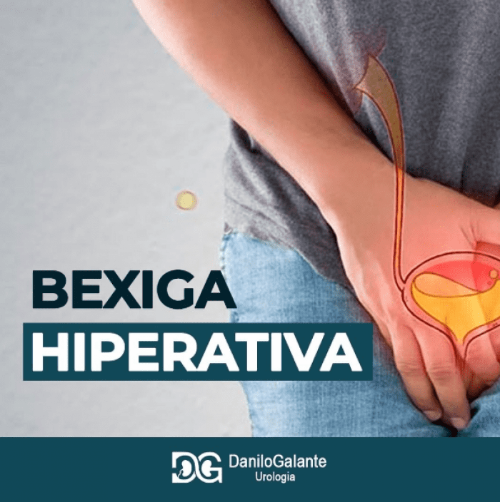 Bexiga Hiperativa