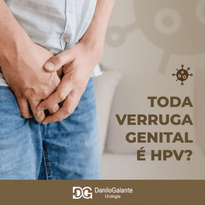 Toda verruga genital é HPV?