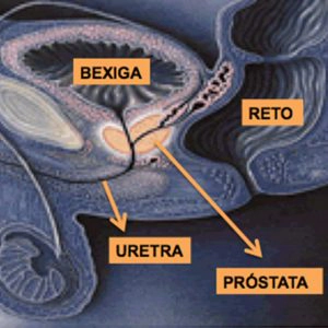 Imagen Prostata